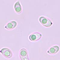 Spores of <em>Cystoderma amianthinum</em>