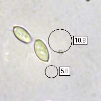 Spores of Lepiota ignivolvata