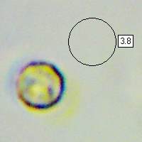 Spores of Lycoperdon perlatum