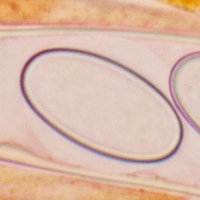 Spore of Cheilymenia fimicola