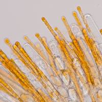 Asci and spores of <em>Cheilymenia stercorea</em>