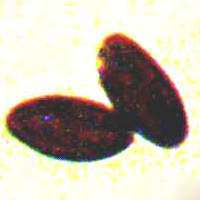 Spores of <em>Daldinia concentrica</em>