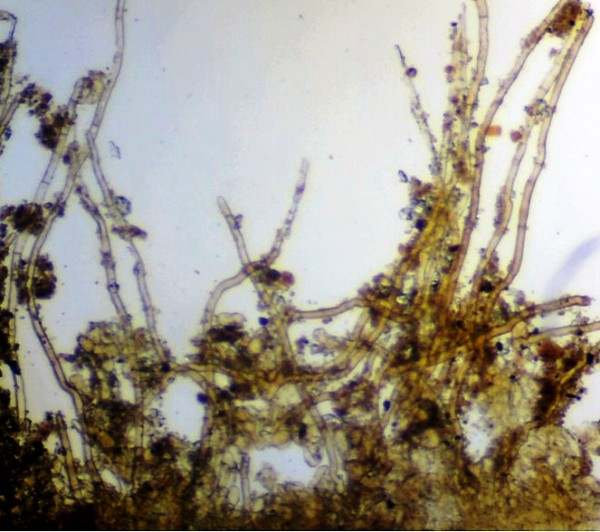 Exterior surface hairs of Cedar Cup <i>Geopora sumneriana</i>