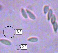 Conidiospores of Brittle Cinder fungus
