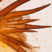 Marginal hairs of Scutellinia mirabilis