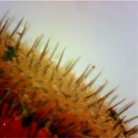 Marginal hairs of Scutellinia scutellata