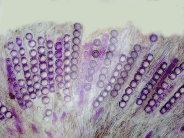 Asci and paraphyses of <i>Scutellinia trechispora</i>