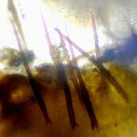 Marginal hairs of Scutellinia trechispora
