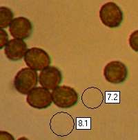 Spores of Cortinarius anomalus