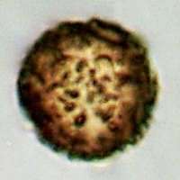 Spores of Astraeus hygrometricus, Barometer Earthstar