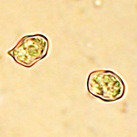 Spores of Entoloma griseocyaneum