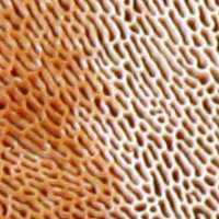 Pore surface of a Blushing Bracket