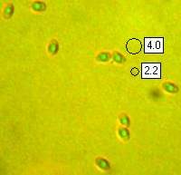 Spores of Postia stiptica