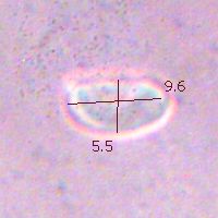 Spores of Hygrocybe subpapillata
