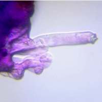 Caulocystidia of Inocybe pusio