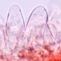 Cheilocystidia of <em>Inocybe stellatospora</em>