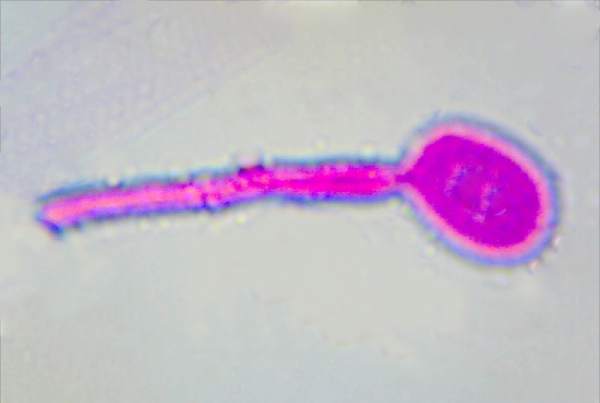 heilocystidium, Favolaschia claudopus