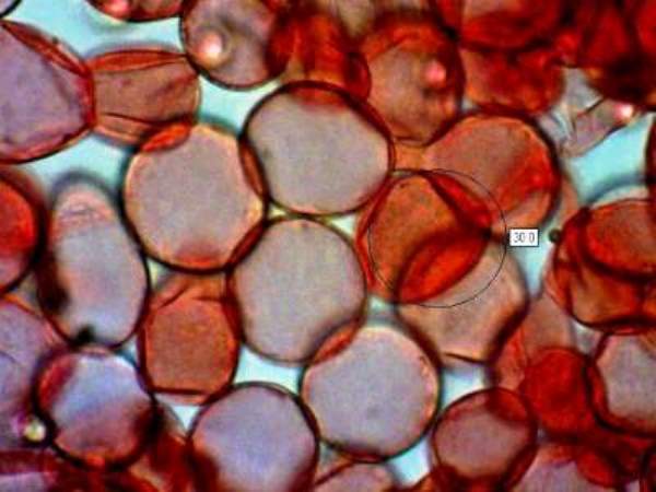 Sphaerocysts in the gill trama of Russula cyanoxantha - Charcoal Burner