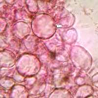 Sphaerocycts of Russula fragilis