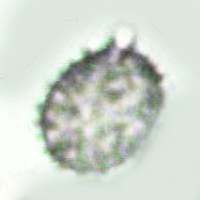 Spores of Russula gracillima, Slender Brittlegill
