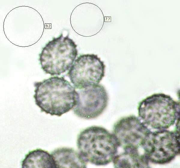 Spores of <i>Russula gracillima</i>, Slender Brittlegill