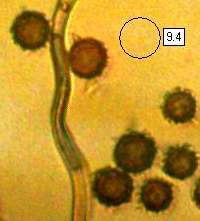 Spores of Scleroderma citrinum