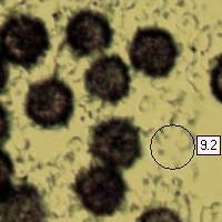 Spores of the Scaly Earthball Scleroderma verrucosum