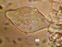 Cheilocystidia of <em>Cyclocybe cylindracea</em>