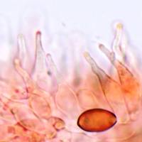 Cheilocystidia of <em>Psilocybe semilanceata</em>