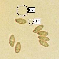 Spores of Suillus variegatus